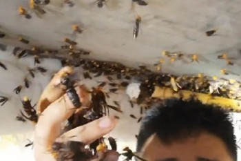 Preživio čak 67 uboda stršljenova