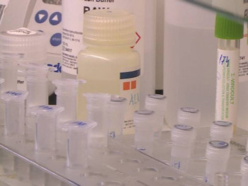 Седма жртва вируса корона у Србији