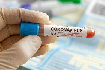 Nevesinjac u trebinjskoj Bolnici nije zaražen virusom korona