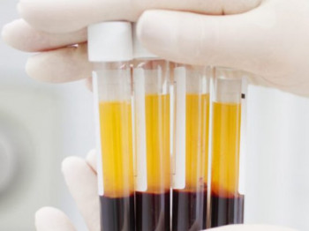 Prvi pacijent u Austriji izliječen krvnom plazmom