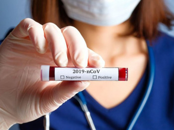 У Српској 103 нова случаја корона вируса