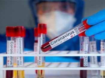 U Trebinju je potvrđeno 13 novih slučajeva virusa korona
