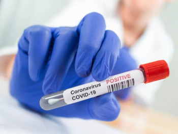 U Srpskoj 66 novih slučajeva virusa korona