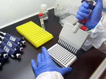 И Република Српска у реду за руску вакцину