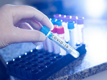 U Srpskoj četiri smrtna slučaja