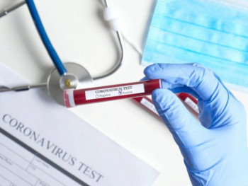 У Српској 139 нових случајева вируса корона