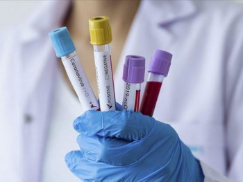 U Srpskoj na virus korona pozitivno 97 osoba; Preminule tri osobe