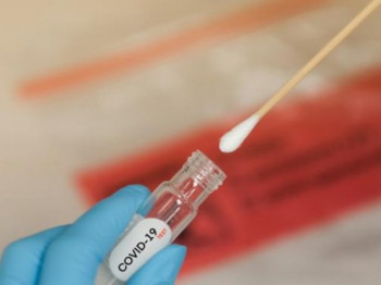 У Српској 123 новообољелих