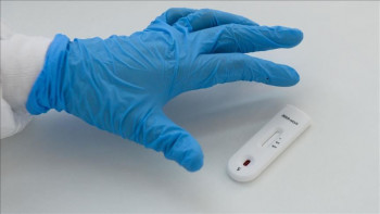 Тестирање само према љекарској процјени