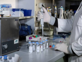 Kod 134 osobe potvrđen virus korona