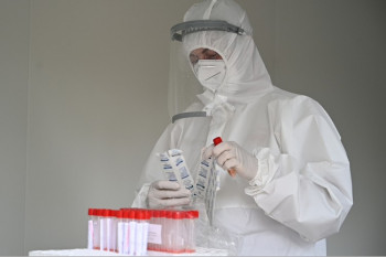 U Srpskoj 27 slučajeva virusa korona