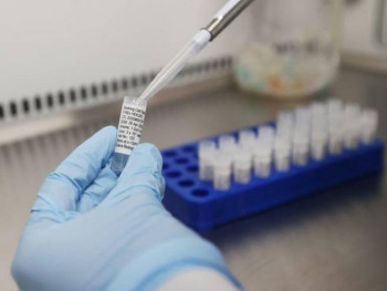 109 novozaraženih u Republici Srpskoj,9 iz Trebinja