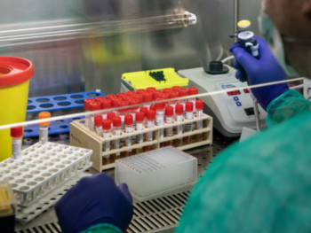 Od posljedica virusa korona preminulo 12 lica