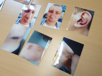 PU Trebinje: Dučić pružao otpor, verbalno i fizički napao policajce na dužnosti