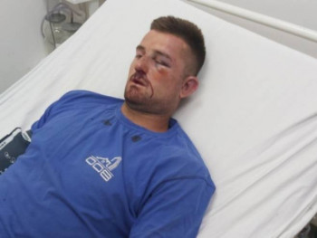 Albanci napali srpskog mladića