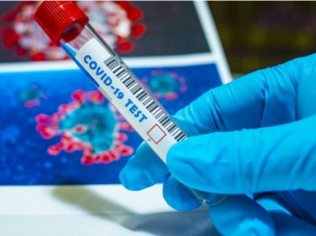 Од короне преминула жена из Невесиња – Пет заражених у болници