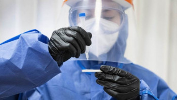 У Требињу нових 28 случајева короне – У Српској преминуло још 14 особа