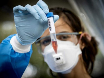 U Srpskoj 15 smrtnih slučajeva; Zaraženo 66 osoba