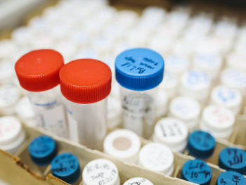 Najveći broj preminulih od početka epidemije – Čak 27 osoba umrlo od korone