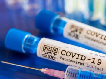 Преминуло 14 заражених – Нових 55 случајева КОВИДА 19