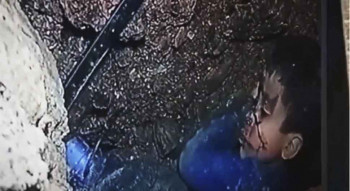 Претужан крај велике борбе: Преминуо дјечак чије је спасавање обишло свијет