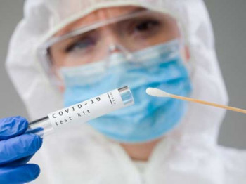 Crna Gora: Zaražene 402 osobe