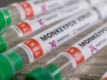 Prvi slučaj majmunskih boginja u Sloveniji