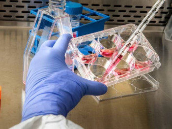 U Hrvatskoj potvrđen prvi slučaj majmunskih boginja