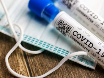 У Српској заражено 85 особа; Преминуло шесторо