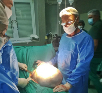 U trebinjskoj Bolnici uspješno odstranjen tumor težine više od 16 kilograma