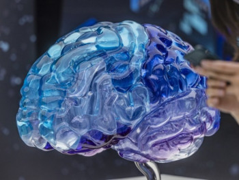 29. oktobar – Svjetski dan borbe protiv moždanog udara