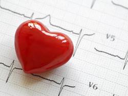 Kardiovaskularne bolesti najčešći uzročnici smrti