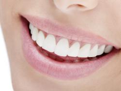 Namirnice koje utiču na promjenu boje zuba