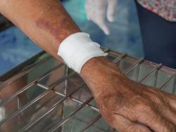 Plik od opekotine nikada ne bi trebalo da bušite